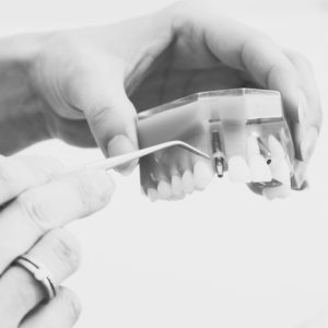 Implantat, Krone oder Brücke: Hände zeigen auf Implantat